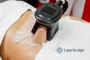Does Fat Freezing At Home Work? 3 Fat freezing at home from Lipo Sculpt Lancashire